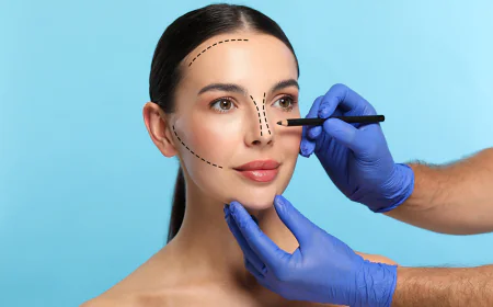 Questions to Ask Before Rhinoplasty