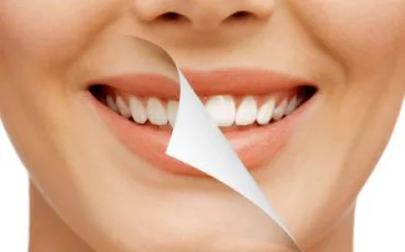 Teeth Whitening in Delhi – Brighten Your Smile Safely and Instantly