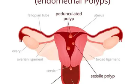 Hysteroscopy Procedure cost in Delhi - Dr Rhythm Gupta