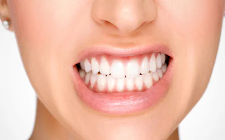 How to Manage Stress to Prevent Teeth Grinding?