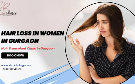 Hair Loss in Women- Can PRP And Hair Transplant Help?