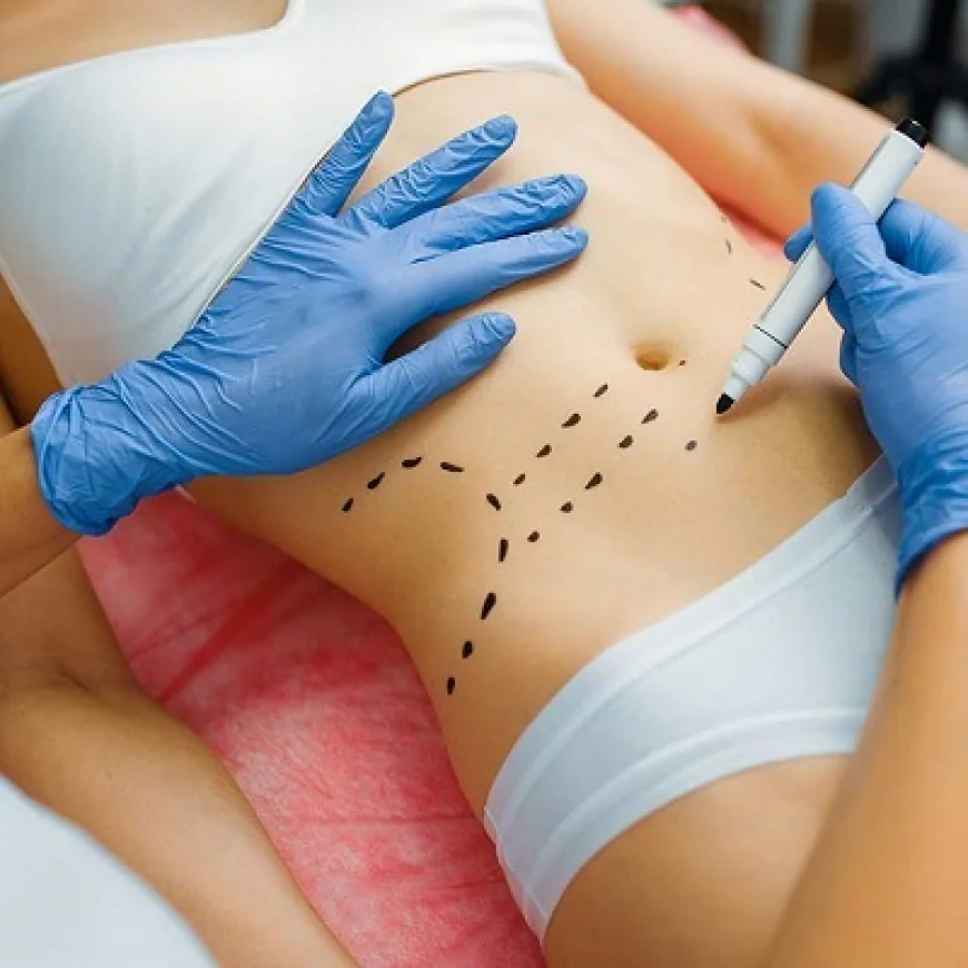 How Much Fat Can Fat Melting Injections Remove Safely?