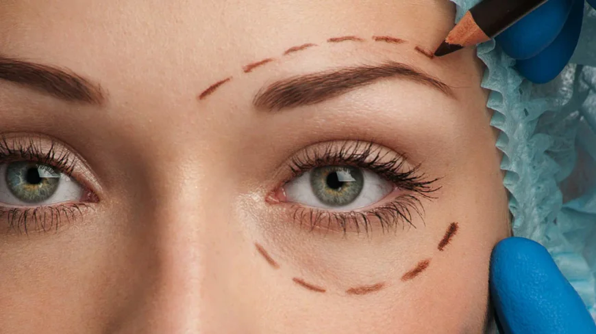 Rediscover Youthful Eyes with Eyelid Surgery in Islamabad