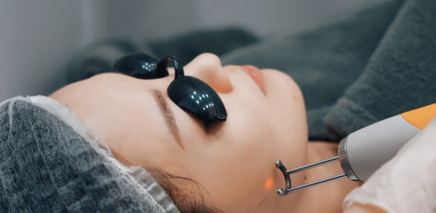 Top Benefits of Choosing PICO Laser Skin Treatment in Dubai