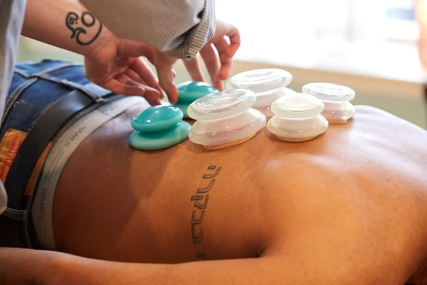 Cupping Therapy in Philadelphia: A Modern Take on an Ancient Practice