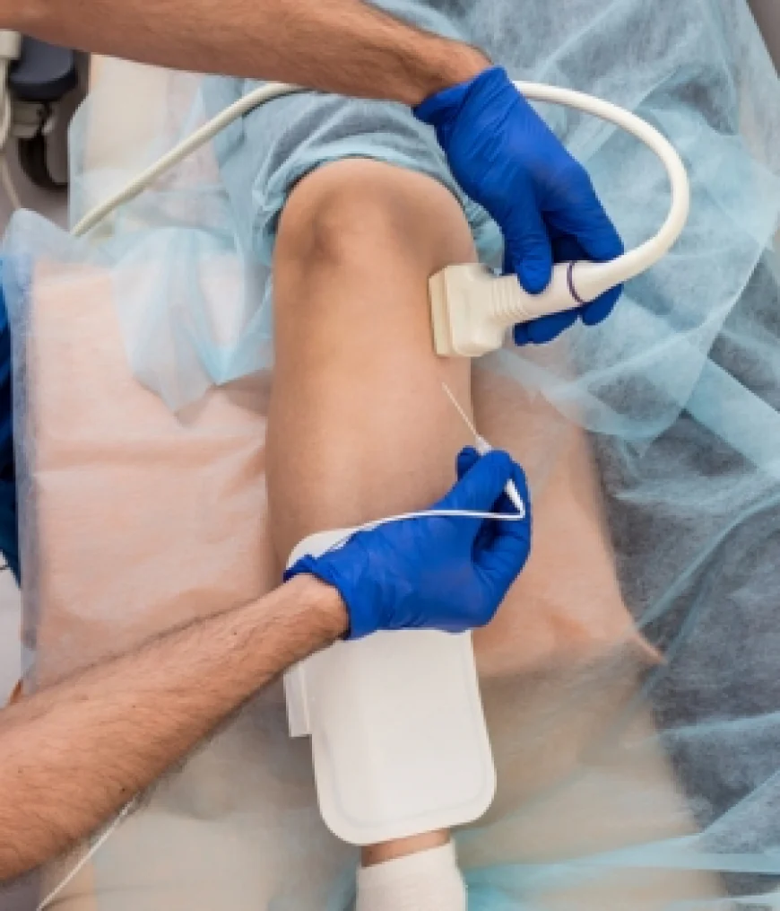 Carotid Artery Disease: When to Consider Surgery