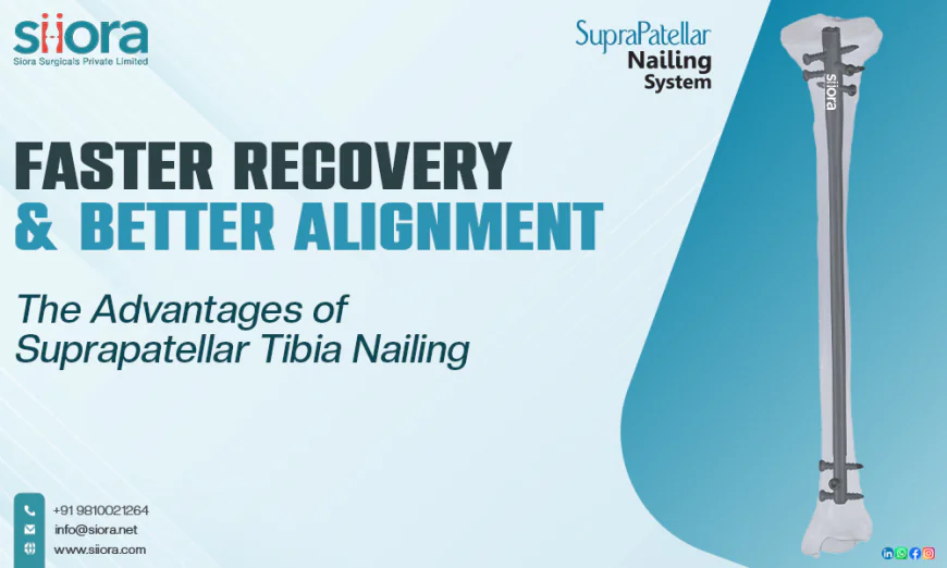 Faster Recovery & Better Alignment: The Advantages of Suprapatellar Tibia Nailing