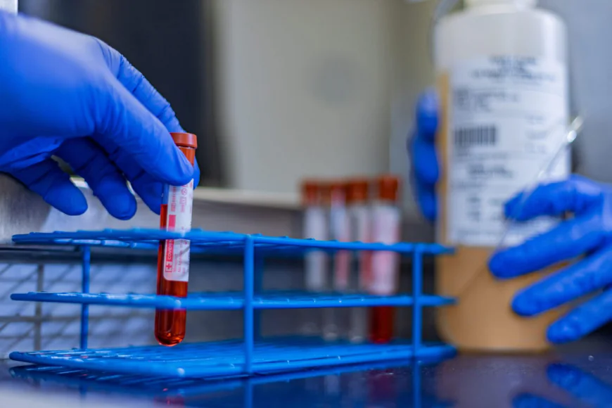 Freedom Plasma: Guide to Plasma Donation & Benefits