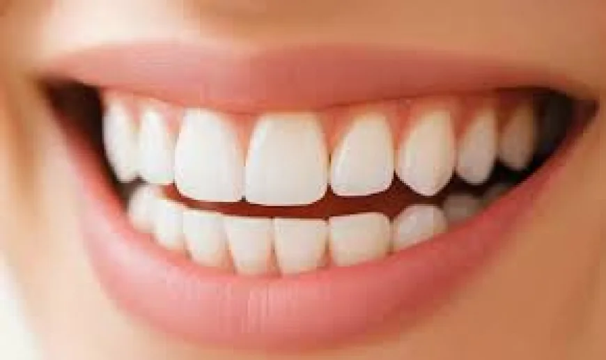 Top 10 Mistakes to Avoid When Getting a Hollywood Smile