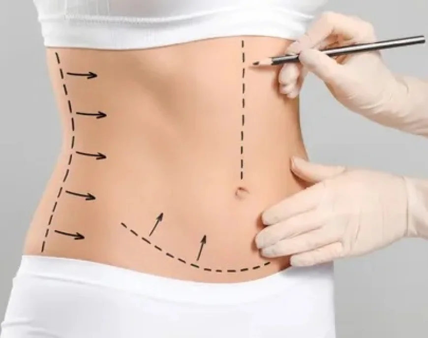 The Science Behind Circumferential Abdominoplasty in Islamabad
