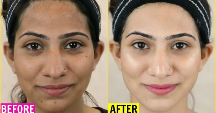 Expert Skin Whitening Specialists in Islamabad