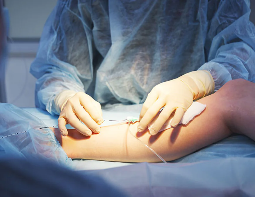 Are Vein Treatments for Spider and Varicose Veins Painful?