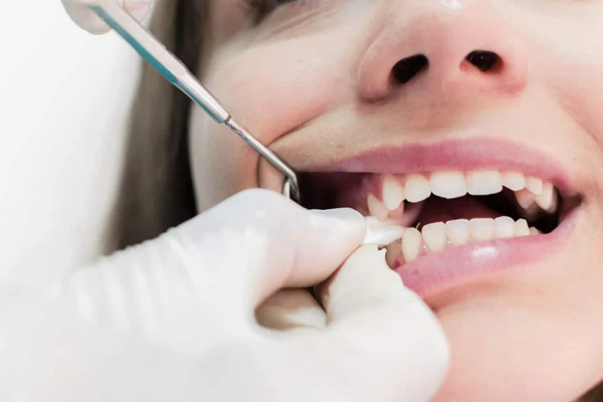 Tooth Extraction