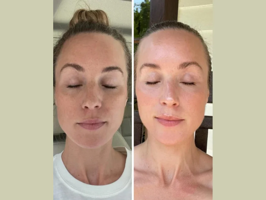 The Art of Rejuvenation: Fotona 4D Laser and the Best Plastic Surgeon in dubai