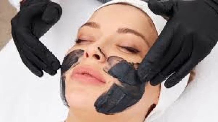 How Does Spectra Laser Carbon Peeling Compare to Chemical Peels?