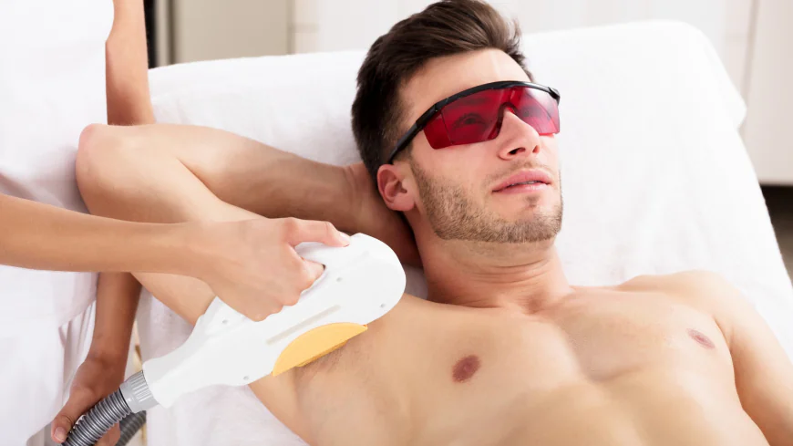 Male Laser Hair Removal