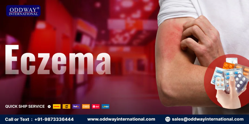 Best Anti Eczema Cream | Eczema Cream for Dry Skin - Oddway