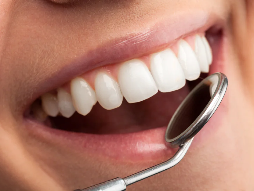 What Are the Long-Term Benefits of Regular Scaling & Polishing?