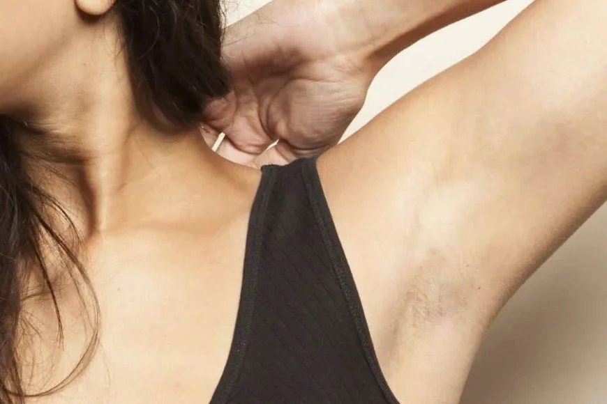 Can Overuse of Peels Cause Armpit Pigmentation?