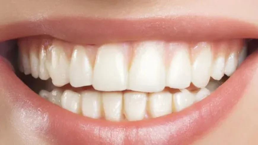 Picture-Perfect Smiles: Dental Veneers in Islamabad Before & After