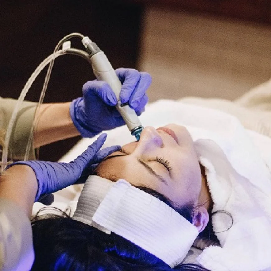 Laser Skin Resurfacing for Stretch Marks: Is It Effective?