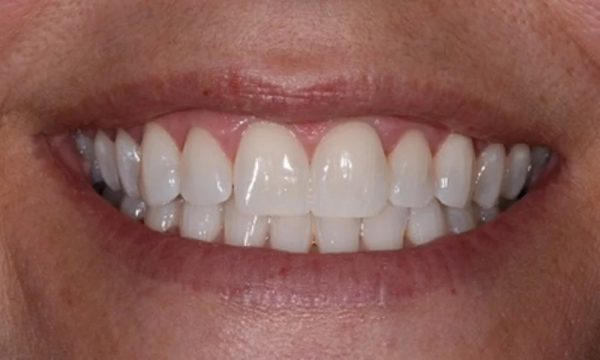 Complete dental care for healthy, beautiful smiles with General Dentistry
