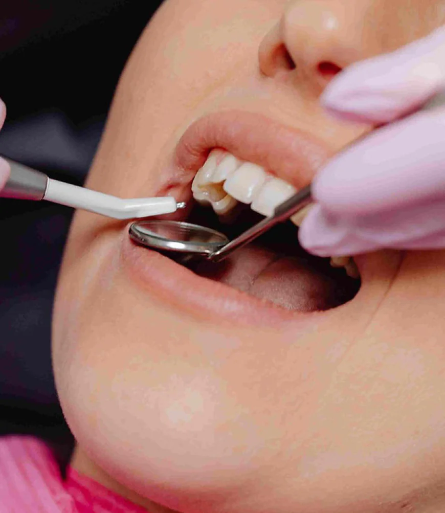 How to Find the Best Dentist for Root Canal Near You?
