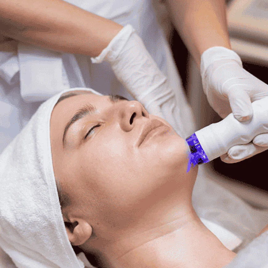 Why Laser Hair Removal Isn’t a One-Time Fix