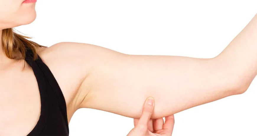 How Long Is the Recovery Period After Arm Liposuction?