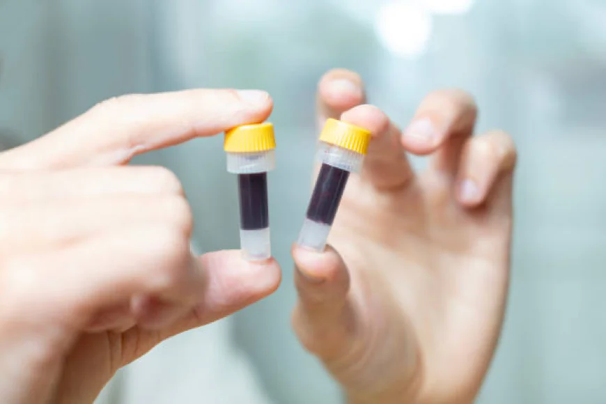 Blood Test At Home – Easy Booking