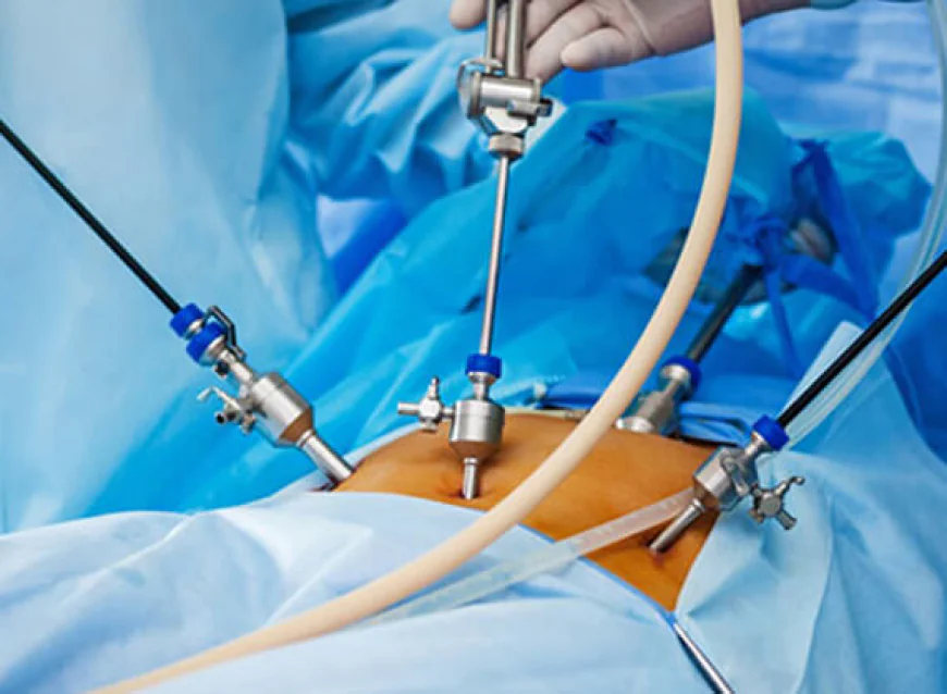 Laparoscopy for Infertility Cost in Delhi - Dr Rhythm Gupta