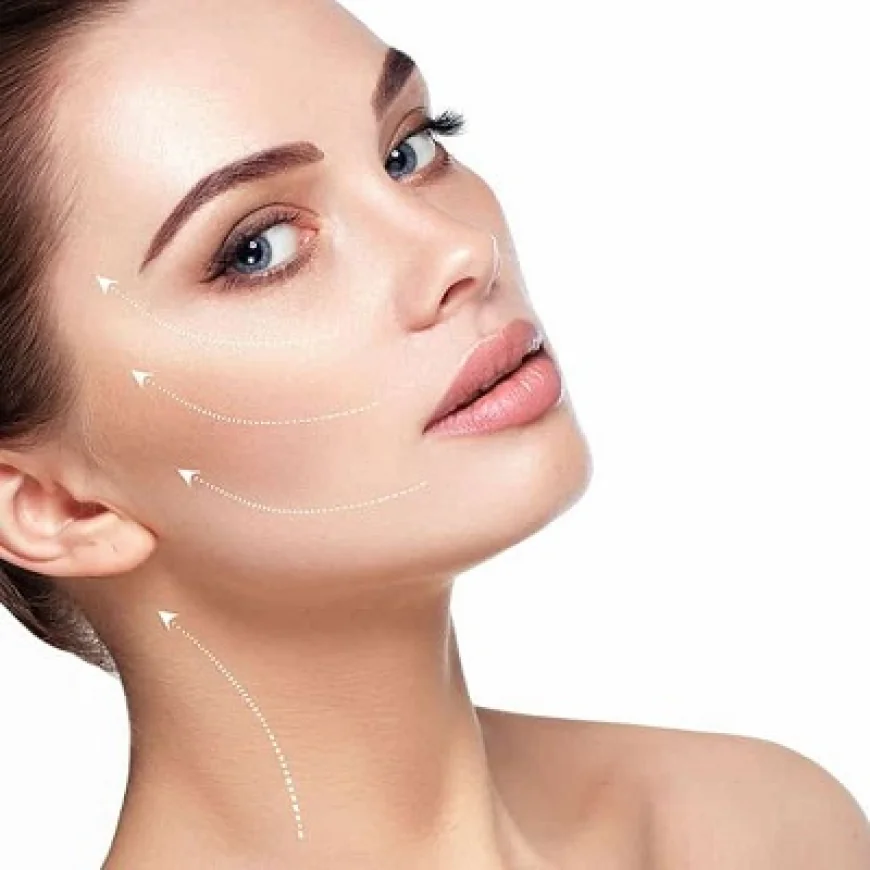 Thread Lift: The Non-Surgical Facelift Revolution