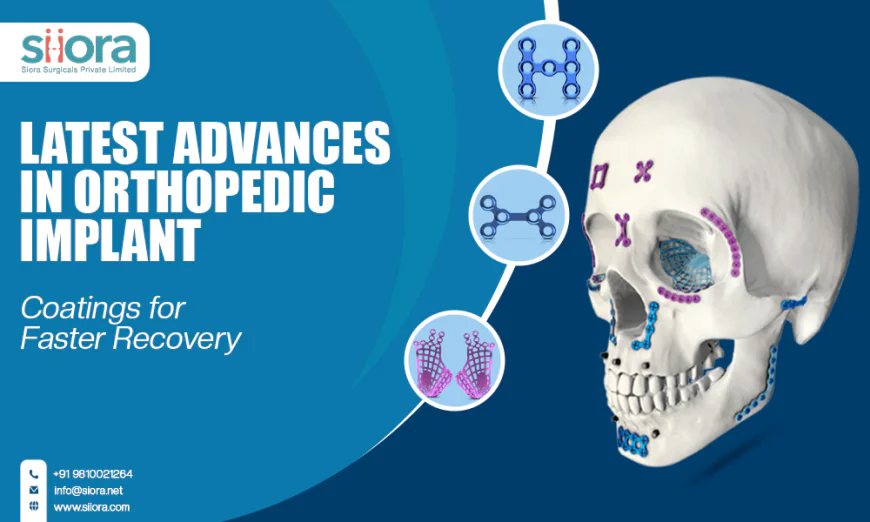 Latest Advances in Orthopedic Implant Coatings for Faster Recovery