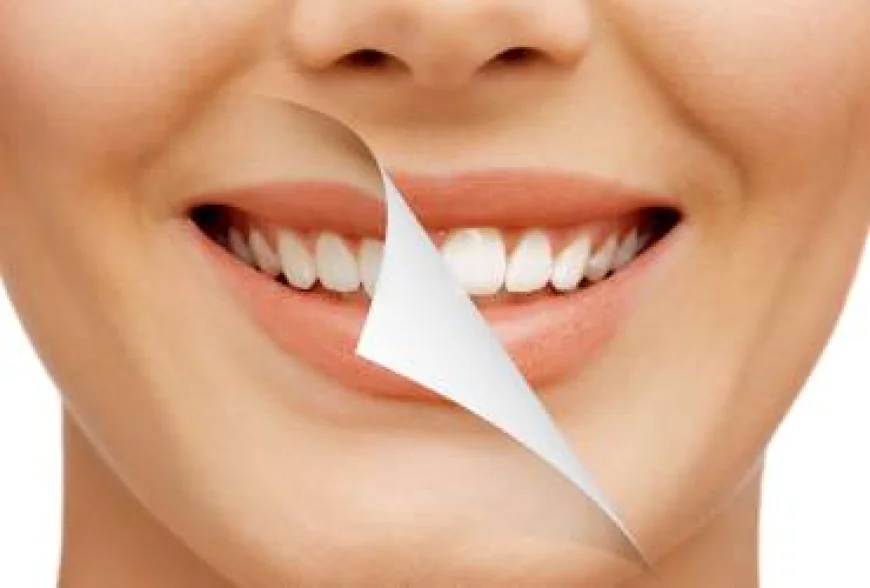 Teeth Whitening in Delhi – Brighten Your Smile Safely and Instantly