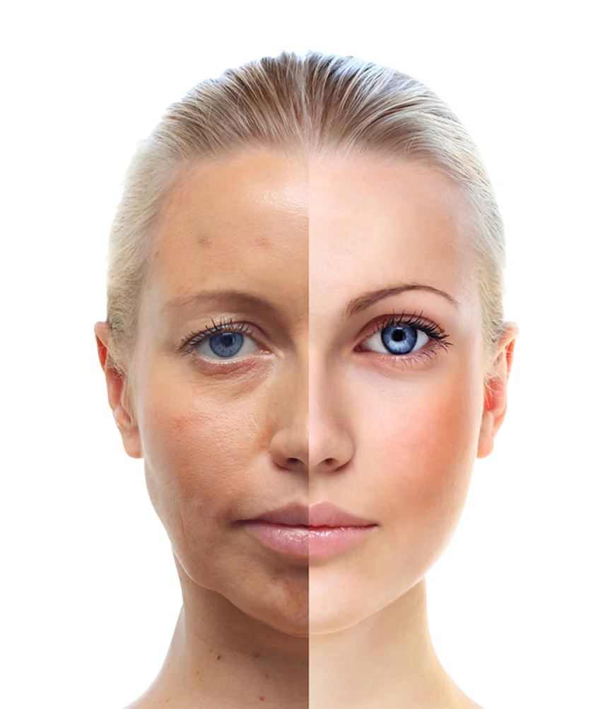 How Facelift Surgery Can Improve Your Appearance
