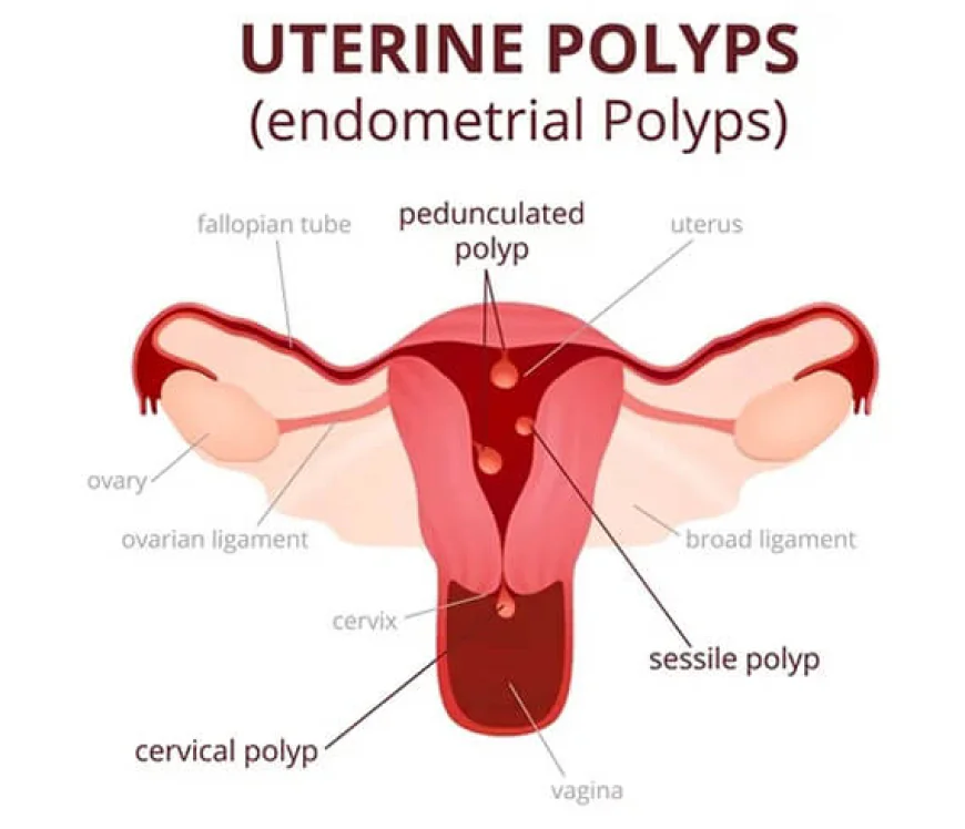 Hysteroscopy Procedure cost in Delhi - Dr Rhythm Gupta