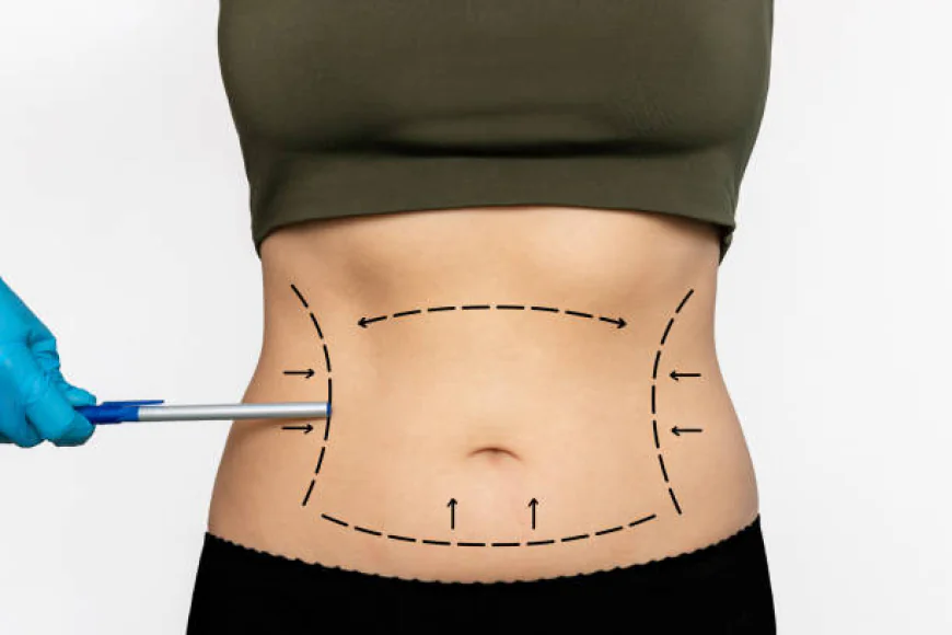 Safe and Effective Liposuction Surgery Services in Riyadh