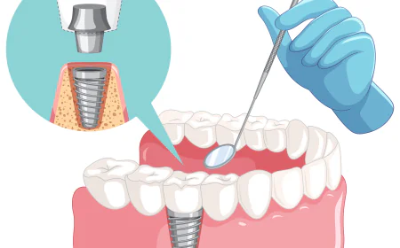 Finding the Right Dental Implant Specialist in London: A Path to Restored Confidence