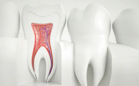 Root Canal Treatment for Infected Teeth in Islamabad