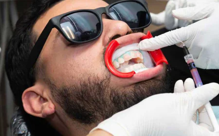 Why Should You Choose a Professional Veneer Dentist?