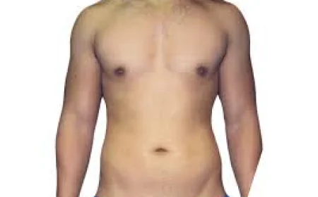 Can a Lower Body Lift Be Combined with Other Cosmetic Surgeries?