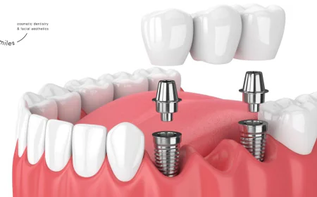 What Happens During a Laser Teeth Whitening Procedure?