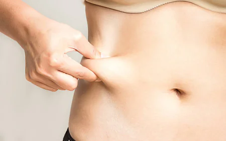 Comparing Fat Reduction Treatments: Liposuction vs. Non-Surgical Methods