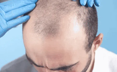 Choosing a Hair Transplant Surgeon: Key Questions to Ask