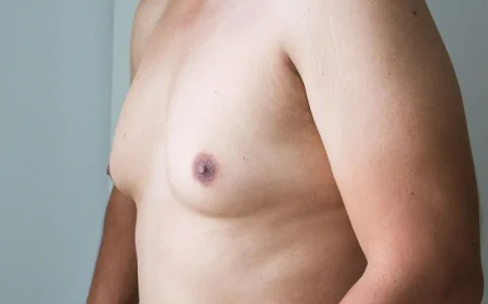 Is Gynecomastia Surgery Permanent? What You Need to Know