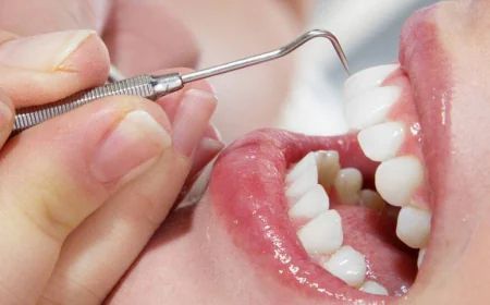 How Often Should You Get Teeth Cleaning in Dubai?