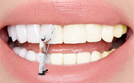 How to Remove Smoking Related Stains from Your Teeth