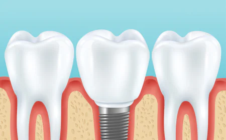 Tooth Cap vs Crown: What Patients Should Know Before Getting Treatment