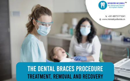 Finding the Best Dental Clinic in Gurgaon: My Experience at Ministry of Smile