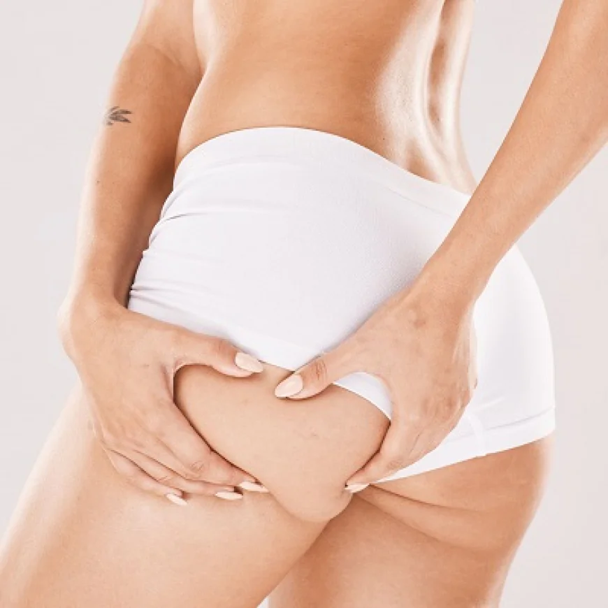 Post-Surgery Care After Buttock Augmentation